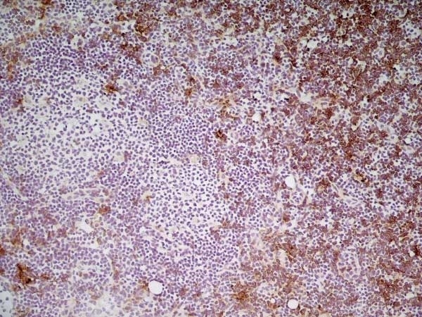 Anti Mouse CD8 Antibody, clone YTS105.18 gallery image 7