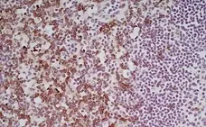 Anti Mouse CD8 Antibody, clone YTS105.18 gallery image 8