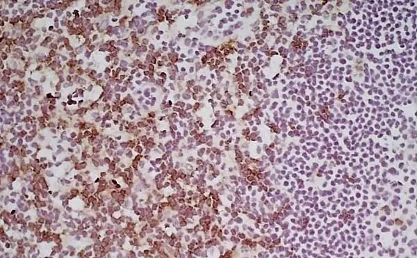 Anti Mouse CD8 Antibody, clone YTS105.18 gallery image 8