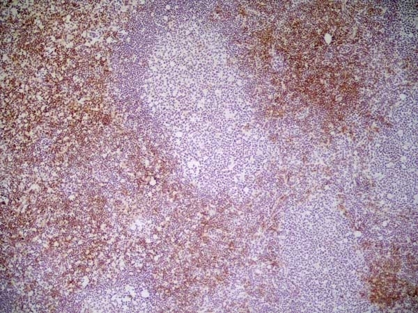 Anti Mouse CD8 Antibody, clone YTS169.4 gallery image 3