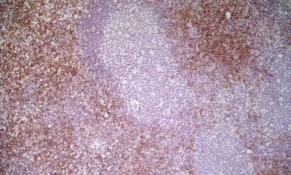 Anti Mouse CD8 Antibody, clone YTS169.4 gallery image 3