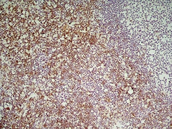 Anti Mouse CD8 Antibody, clone YTS169.4 gallery image 4