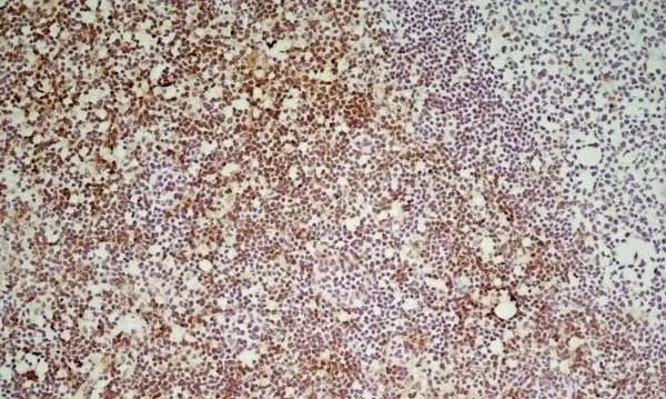 Anti Mouse CD8 Antibody, clone YTS169.4 gallery image 4