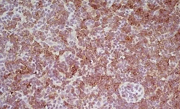 Anti Mouse CD8 Antibody, clone YTS169.4 gallery image 5