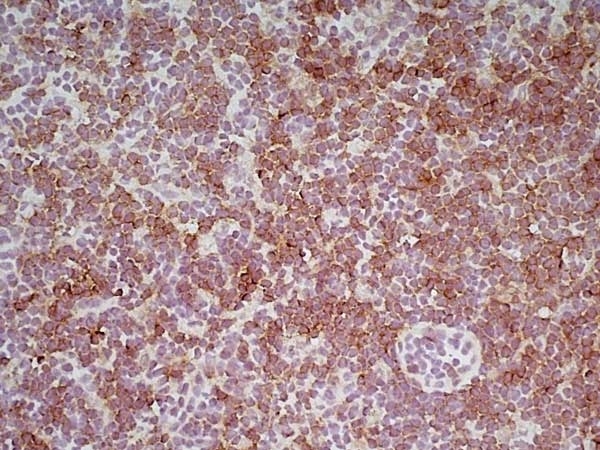 Anti Mouse CD8 Antibody, clone YTS169.4 gallery image 5