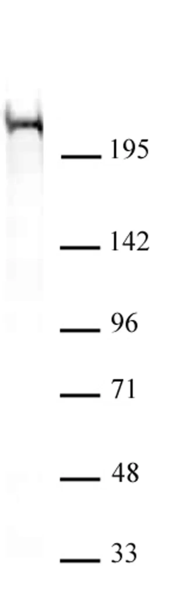 Anti Mouse CHD5 Antibody, clone 5A10 gallery image 2