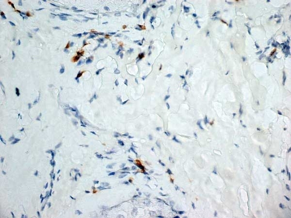 Anti Mouse Dectin-1 Antibody, clone 2A11 gallery image 10