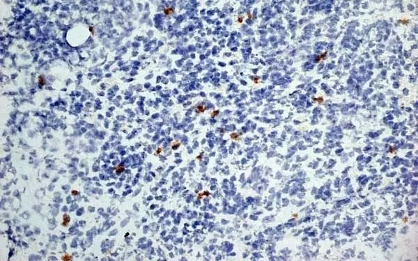 Anti Mouse Dectin-1 Antibody, clone 2A11 gallery image 7