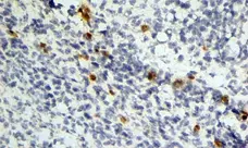 Anti Mouse Dectin-1 Antibody, clone 2A11 gallery image 8
