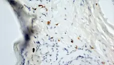 Anti Mouse Dectin-1 Antibody, clone 2A11 gallery image 9
