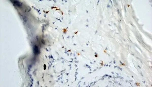 Anti Mouse Dectin-1 Antibody, clone 2A11 gallery image 9