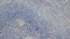 Anti Mouse Delta-Like Protein 1 Antibody, clone HMD1-5 gallery image 2