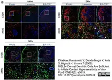 Anti Mouse ER-TR7 Antibody, clone ER-TR7 gallery image 1
