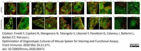 Anti Mouse ER-TR7 Antibody, clone ER-TR7 gallery image 10