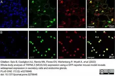 Anti Mouse F4/80 Antibody, clone Cl:A3-1 gallery image 111