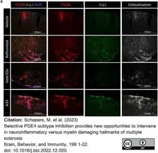 Anti Mouse F4/80 Antibody, clone Cl:A3-1 gallery image 113