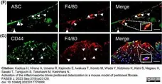 Anti Mouse F4/80 Antibody, clone Cl:A3-1 gallery image 146