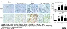 Anti Mouse F4/80 Antibody, clone Cl:A3-1 gallery image 152