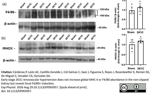 Rat Anti-Mouse F4/80 Antibody, Clone Cl:A3-1 gallery image 191