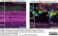 Anti Mouse F4/80 Antibody, clone Cl:A3-1 gallery image 60