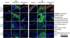 Anti Mouse Gr-1 Antibody, clone RB6-8C5 gallery image 22