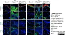 Anti Mouse Gr-1 Antibody, clone RB6-8C5 gallery image 24