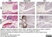 Anti Mouse Gr-1 Antibody, clone RB6-8C5 thumbnail image 30