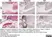 Anti Mouse Gr-1 Antibody, clone RB6-8C5 thumbnail image 30