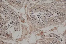 Anti Mouse JAGGED2 Antibody, clone HMJ2-1 gallery image 2