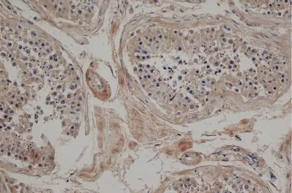 Anti Mouse JAGGED2 Antibody, clone HMJ2-1 gallery image 2