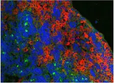Anti Mouse Ly-6B.2 Alloantigen Antibody, clone 7/4 gallery image 20