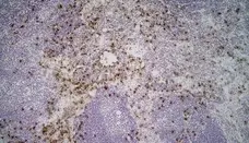 Anti Mouse Ly-6B.2 Alloantigen Antibody, clone 7/4 gallery image 21
