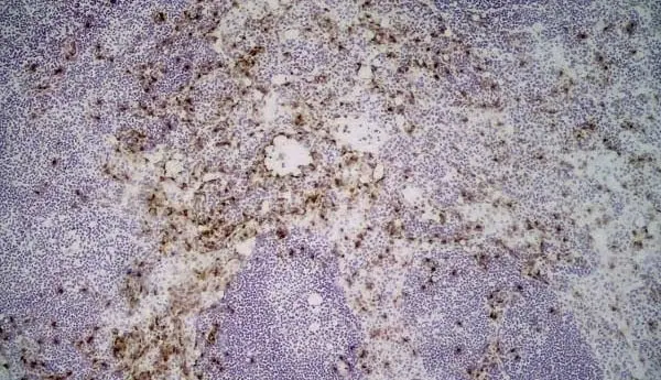 Anti Mouse Ly-6B.2 Alloantigen Antibody, clone 7/4 gallery image 21