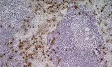 Anti Mouse Ly-6B.2 Alloantigen Antibody, clone 7/4 gallery image 22