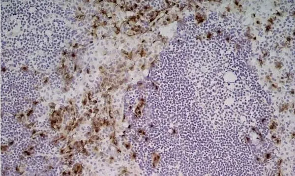 Anti Mouse Ly-6B.2 Alloantigen Antibody, clone 7/4 gallery image 22
