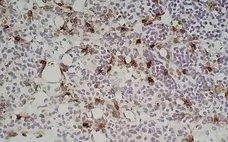 Anti Mouse Ly-6B.2 Alloantigen Antibody, clone 7/4 gallery image 23