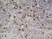 Anti Mouse Ly-6B.2 Alloantigen Antibody, clone 7/4 thumbnail image 23