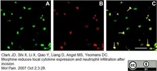 Anti Mouse Ly-6B.2 Alloantigen Antibody, clone 7/4 gallery image 26