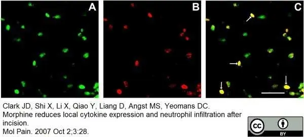 Anti Mouse Ly-6B.2 Alloantigen Antibody, clone 7/4 gallery image 26