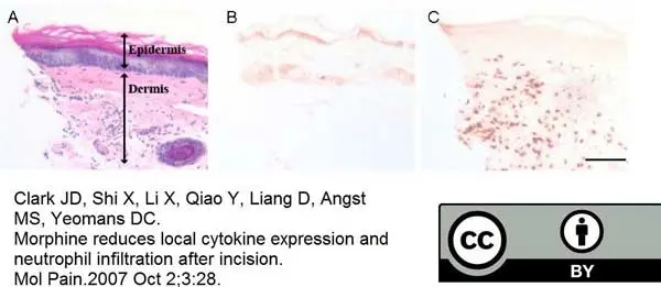 Anti Mouse Ly-6B.2 Alloantigen Antibody, clone 7/4 gallery image 28
