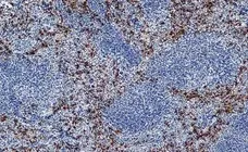 Anti Mouse Ly-6B.2 Alloantigen Antibody, clone 7/4 gallery image 37