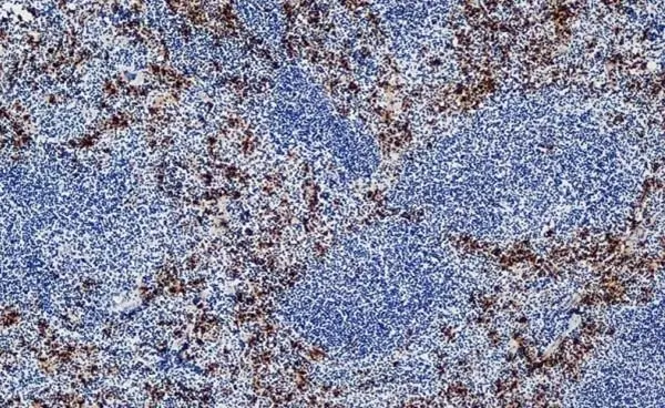 Anti Mouse Ly-6B.2 Alloantigen Antibody, clone 7/4 gallery image 37