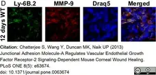 Anti Mouse Ly-6B.2 Alloantigen Antibody, clone 7/4 gallery image 42