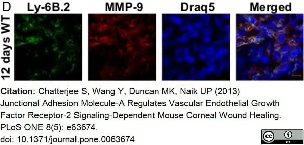 Anti Mouse Ly-6B.2 Alloantigen Antibody, clone 7/4 gallery image 42