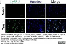 Anti Mouse Ly-6B.2 Alloantigen Antibody, clone 7/4 gallery image 47
