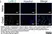 Anti Mouse Ly-6B.2 Alloantigen Antibody, clone 7/4 thumbnail image 47