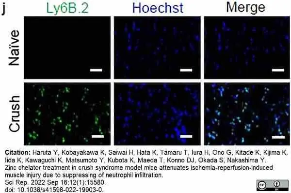 Anti Mouse Ly-6B.2 Alloantigen Antibody, clone 7/4 gallery image 47