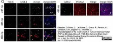 Anti Mouse Ly-6B.2 Alloantigen Antibody, clone 7/4 gallery image 51