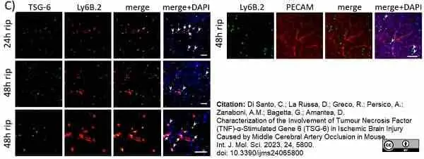 Anti Mouse Ly-6B.2 Alloantigen Antibody, clone 7/4 gallery image 51