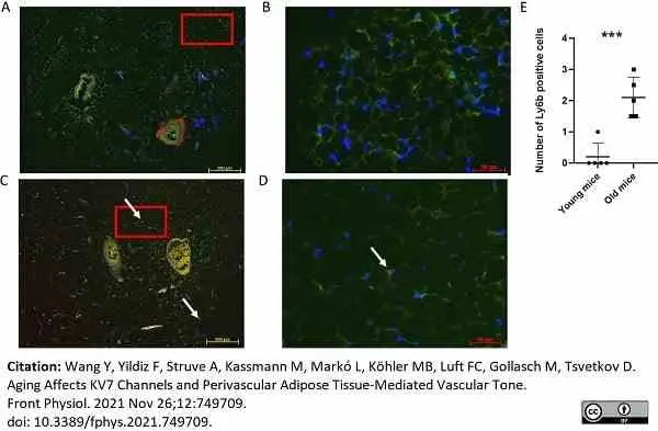Anti Mouse Ly-6B.2 Alloantigen Antibody, clone 7/4 gallery image 57